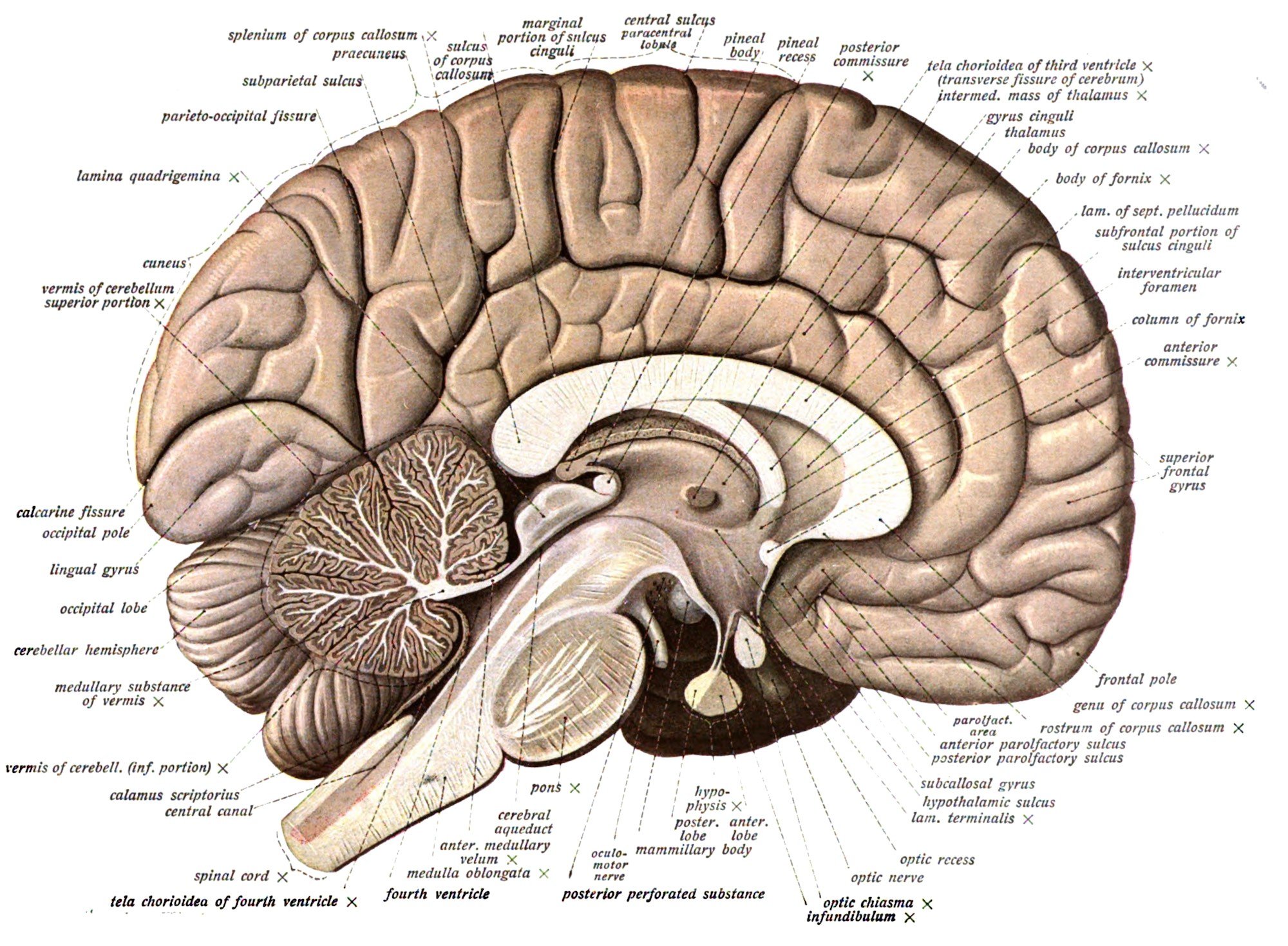 Przekrój wzdłuż mózgu. Uwidocznione struktury u dołu należą do układu limbicznego, który ulega uszkodzeniu podczas niedoboru tiaminy.